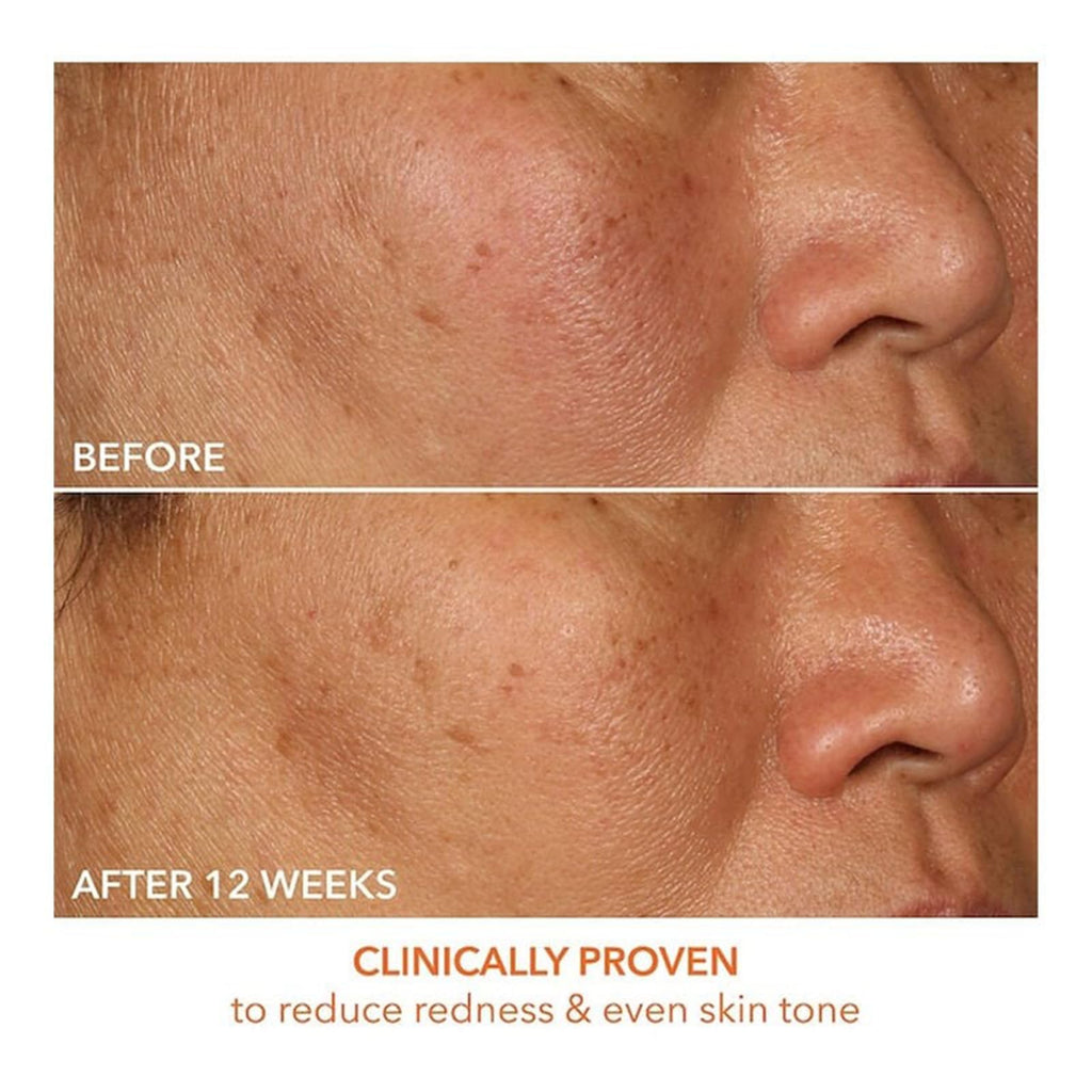 Dr Dennis Gross Vitamin C Lactic 15% Firm & Brighten Serum: Visibly Improve Signs of Aging, 1 oz