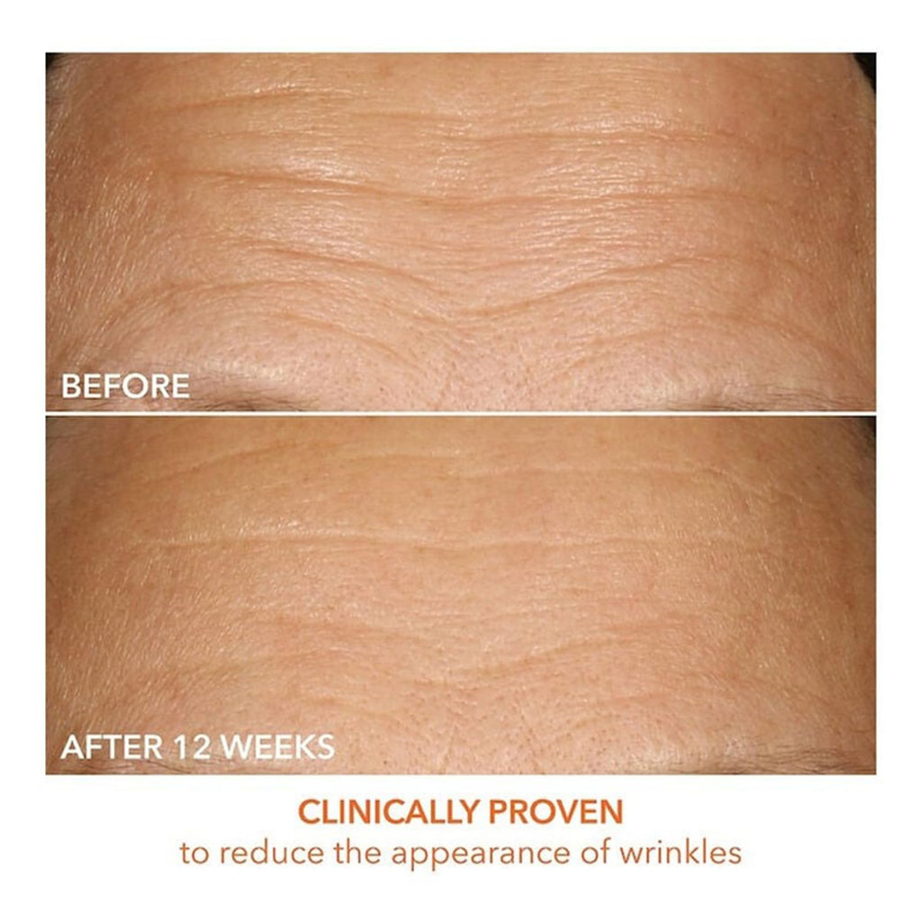 Dr Dennis Gross Vitamin C Lactic 15% Firm & Brighten Serum: Visibly Improve Signs of Aging, 1 oz