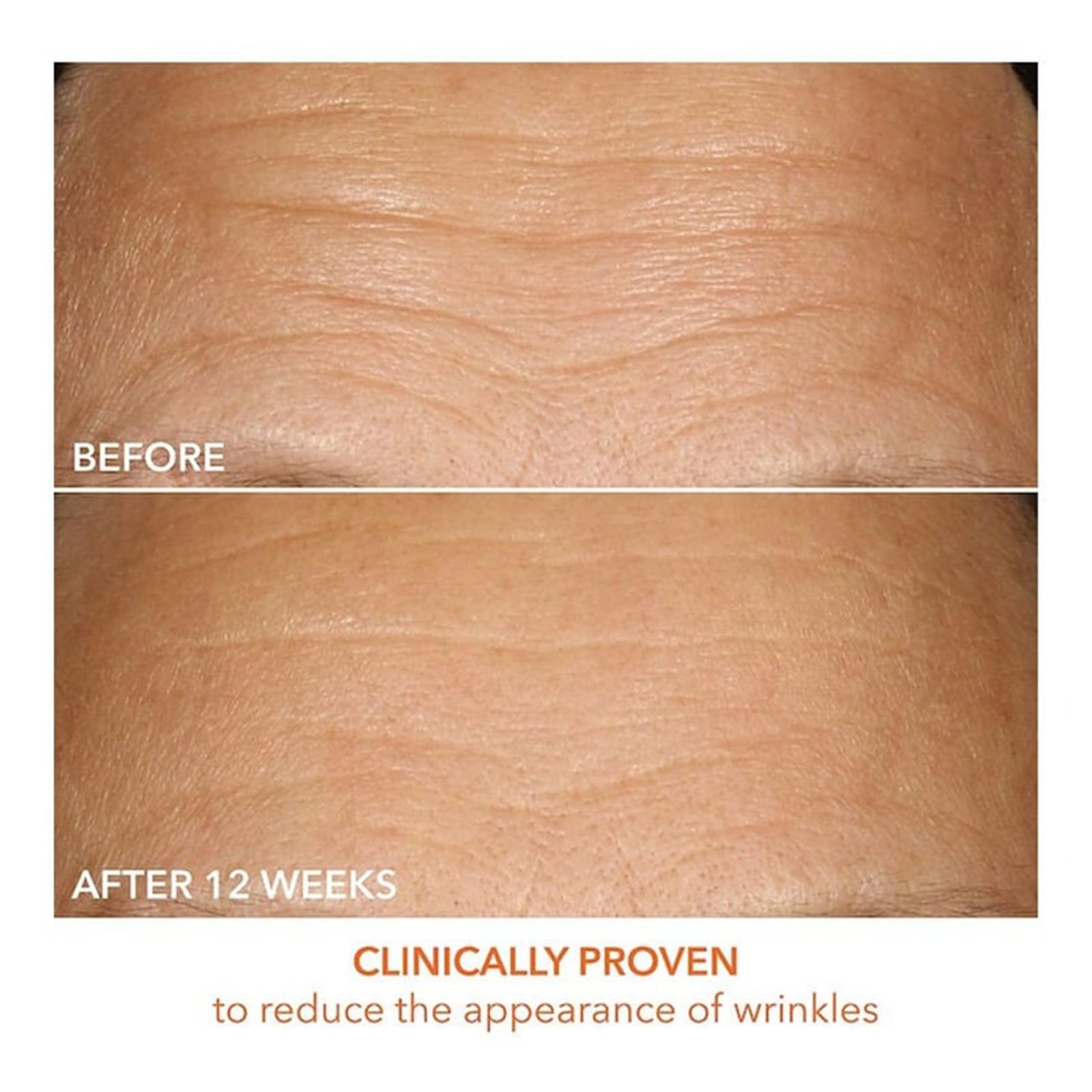 Dr Dennis Gross Vitamin C Lactic 15% Firm & Brighten Serum: Visibly Improve Signs of Aging, 1 oz